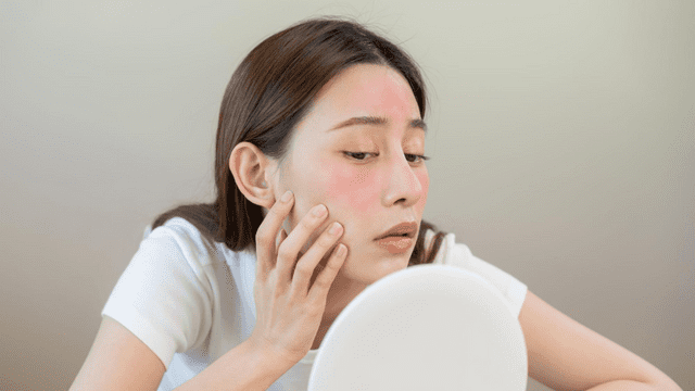 敏感肌判斷